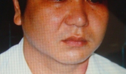 Thầy giáo tạt axit vào mặt lãnh đạo do bức xúc khi bị chuyển công tác